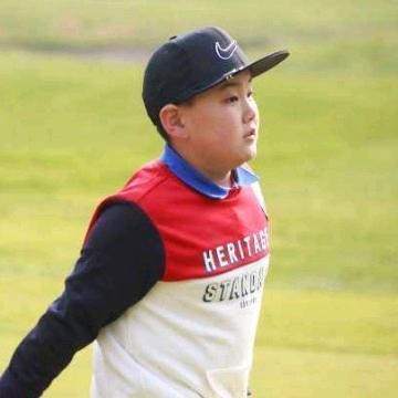 坤佳口腔診所怎么樣（北京坤佳口腔診所種植牙案例分享） 結(jié)構(gòu)地下室施工 第5張