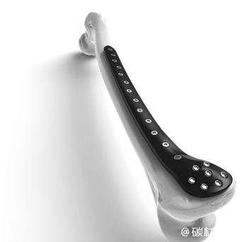 碳纖維材料在醫(yī)療領(lǐng)域的創(chuàng)新應用，碳纖維材料在醫(yī)療領(lǐng)域的創(chuàng)新應用與前景展望 行業(yè)新聞 第6張