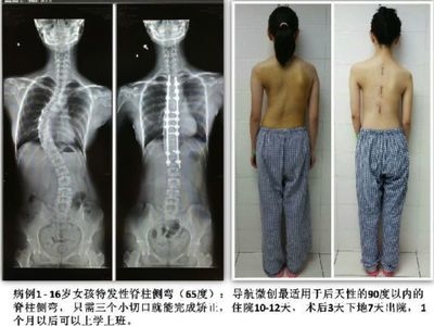 加固效果評估的實際案例，加固效果評估實際案例 行業(yè)新聞 第4張